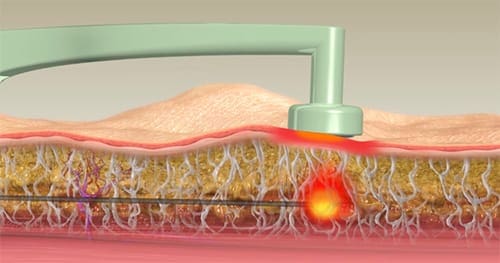 9208e169 2a9f 4d11 8d18 908936bdce41